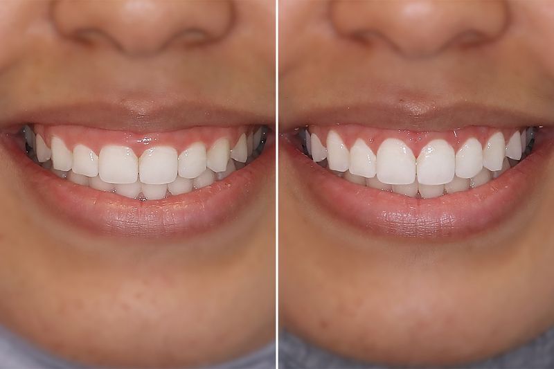 Before & After
